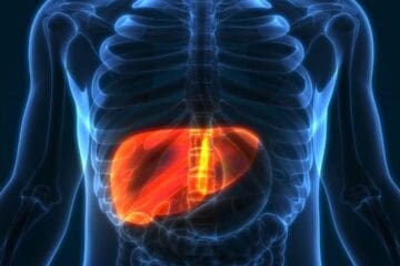 fatty-liver disease
